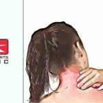 Referred Pain