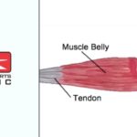 Muscle Tear - Feature Image