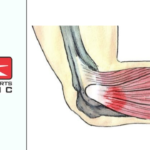 Calgary Sports Physio