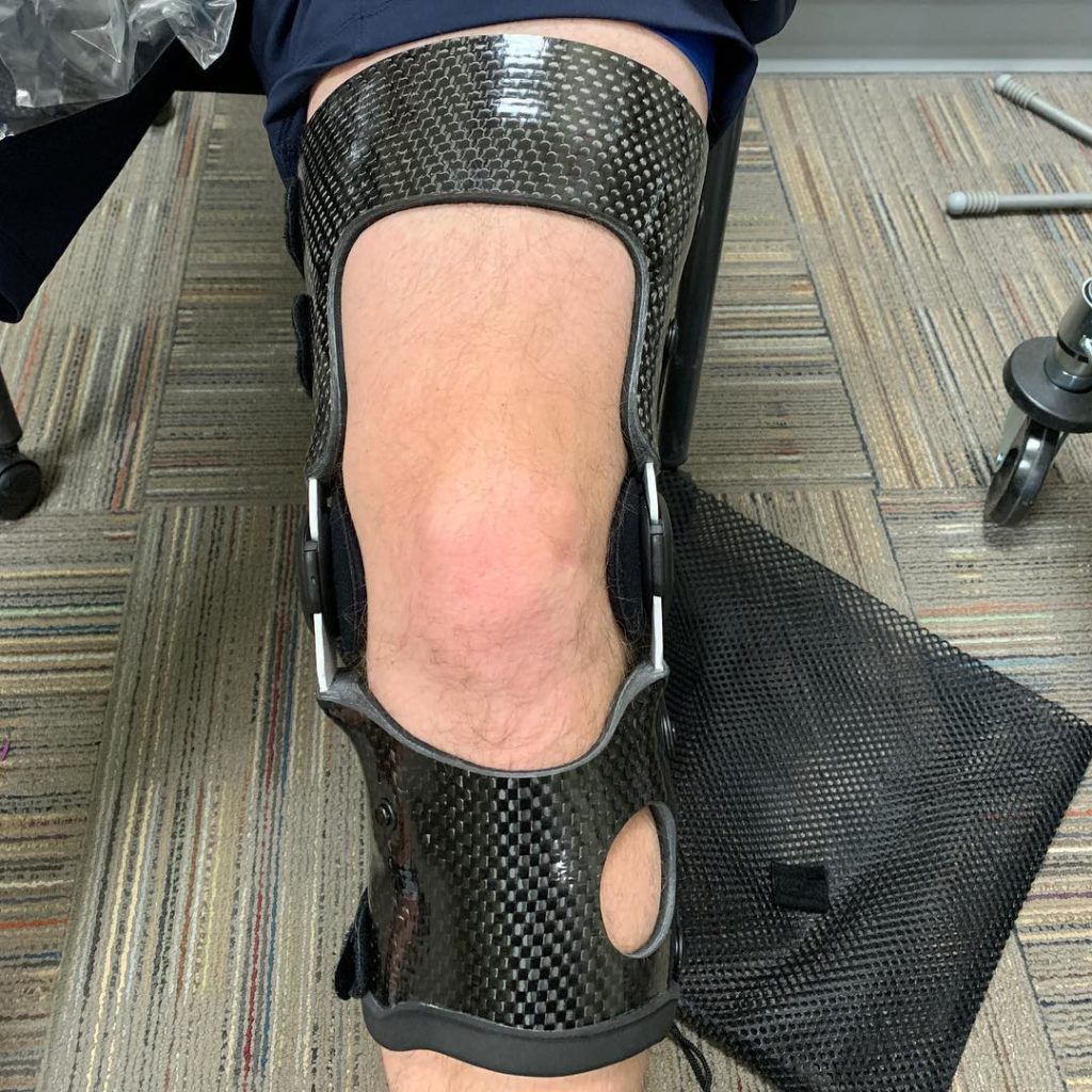 Custom Knee Brace for Different Conditions Knee Brace Experts Calgary